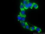 CCT2 Antibody in Immunocytochemistry (ICC/IF)