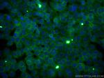 CD59 Antibody in Immunocytochemistry (ICC/IF)