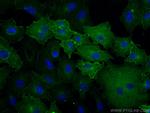 CA12 Antibody in Immunocytochemistry (ICC/IF)