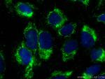 HIGD1A Antibody in Immunocytochemistry (ICC/IF)
