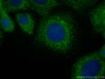GPSM1 Antibody in Immunocytochemistry (ICC/IF)
