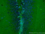 DCLK1 Antibody in Immunohistochemistry (PFA fixed) (IHC (PFA))