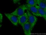 FBXO17 Antibody in Immunocytochemistry (ICC/IF)