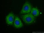 ABL1 Antibody in Immunocytochemistry (ICC/IF)