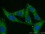ABL1 Antibody in Immunocytochemistry (ICC/IF)