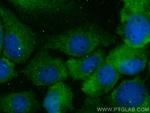 SNX9 Antibody in Immunocytochemistry (ICC/IF)