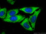 ZER1 Antibody in Immunocytochemistry (ICC/IF)