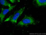 RPS20 Antibody in Immunocytochemistry (ICC/IF)