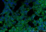 CRMP5 Antibody in Immunocytochemistry (ICC/IF)