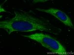 RABEP1 Antibody in Immunocytochemistry (ICC/IF)