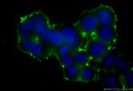 SERCA3 Antibody in Immunocytochemistry (ICC/IF)