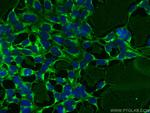 NRCAM Antibody in Immunocytochemistry (ICC/IF)