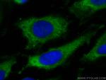 PAK4 Antibody in Immunocytochemistry (ICC/IF)