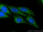 DLAT Antibody in Immunocytochemistry (ICC/IF)