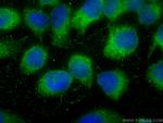 SNX18 Antibody in Immunocytochemistry (ICC/IF)