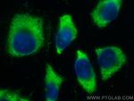 MOCS2 Antibody in Immunocytochemistry (ICC/IF)