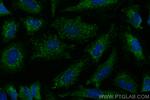 EXOSC10 Antibody in Immunocytochemistry (ICC/IF)