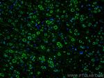 Ataxin 2 Antibody in Immunohistochemistry (PFA fixed) (IHC (PFA))