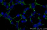 PBLD Antibody in Immunocytochemistry (ICC/IF)