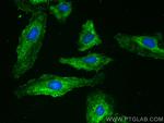 AZI2 Antibody in Immunocytochemistry (ICC/IF)