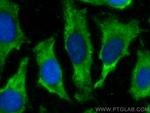 EPS8L2 Antibody in Immunocytochemistry (ICC/IF)