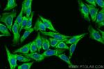 CCS Antibody in Immunocytochemistry (ICC/IF)