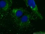 DNAJC21 Antibody in Immunocytochemistry (ICC/IF)
