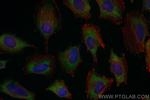 MCTS1 Antibody in Immunocytochemistry (ICC/IF)