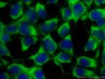 TSC2 Antibody in Immunocytochemistry (ICC/IF)