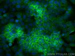 Beta-2-Microglobulin Antibody in Immunocytochemistry (ICC/IF)