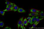 ALDOB Antibody in Immunocytochemistry (ICC/IF)