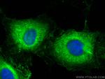 AMOTL2 Antibody in Immunocytochemistry (ICC/IF)