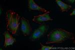 HIP1R Antibody in Immunocytochemistry (ICC/IF)