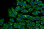 CHMP7 Antibody in Immunocytochemistry (ICC/IF)
