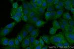 STUB1 Antibody in Immunocytochemistry (ICC/IF)