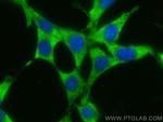 MPI Antibody in Immunocytochemistry (ICC/IF)