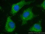 VPS4B Antibody in Immunocytochemistry (ICC/IF)