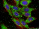 EIF2S1 Antibody in Immunocytochemistry (ICC/IF)