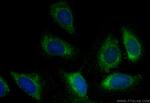 OTUB1 Antibody in Immunocytochemistry (ICC/IF)