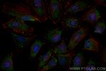 PEX19 Antibody in Immunocytochemistry (ICC/IF)