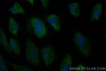 Angiopoietin 1 Antibody in Immunocytochemistry (ICC/IF)