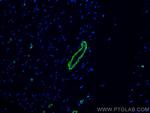 smooth muscle actin Antibody in Immunohistochemistry (PFA fixed) (IHC (PFA))