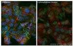 Phospho-Beta Catenin (Ser675) Antibody in Immunocytochemistry (ICC/IF)