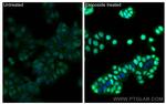 Phospho-P53 (Ser15) Antibody in Immunocytochemistry (ICC/IF)