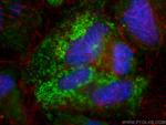 Perilipin-2 Antibody in Immunocytochemistry (ICC/IF)
