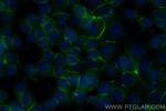 E-cadherin Antibody in Immunocytochemistry (ICC/IF)
