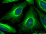 Beta Tubulin Antibody in Immunocytochemistry (ICC/IF)