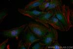 KEAP1 Antibody in Immunocytochemistry (ICC/IF)