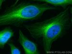 Alpha Tubulin Antibody in Immunocytochemistry (ICC/IF)