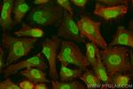 p38 MAPK Antibody in Immunocytochemistry (ICC/IF)